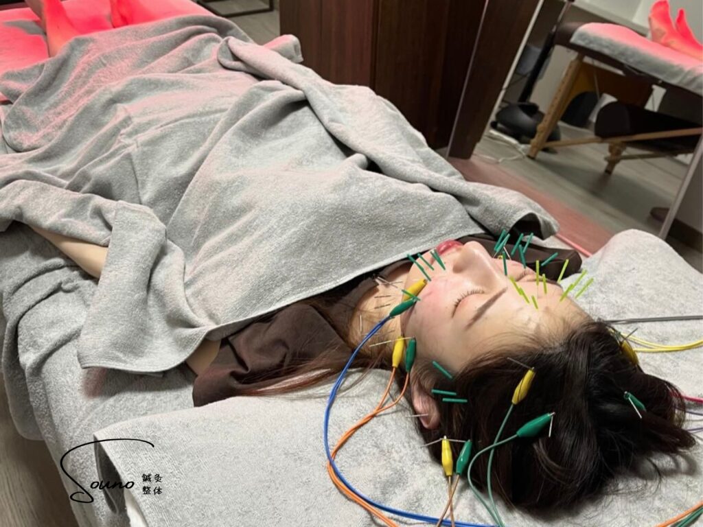 立体造顔美容鍼